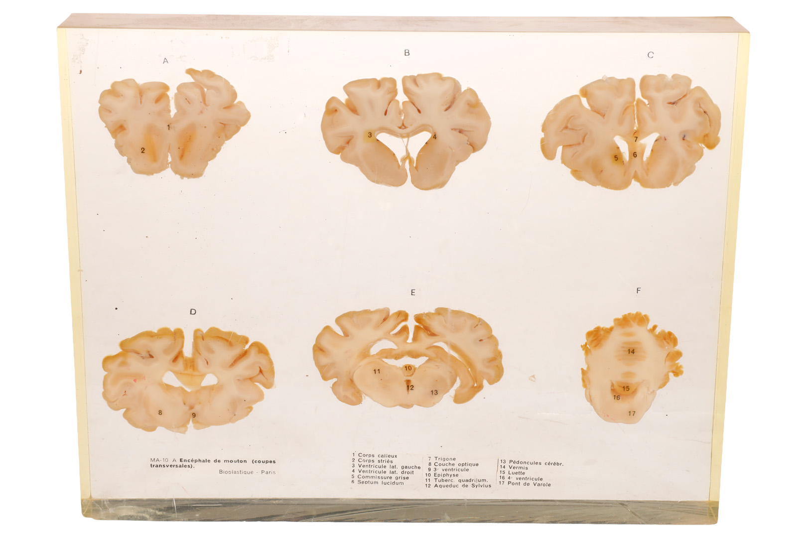 जैविक कटाव मॉडल "Encephale de mouton"